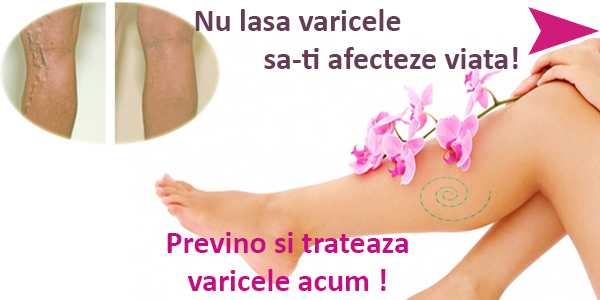 Ciorapi Medicinali Varice